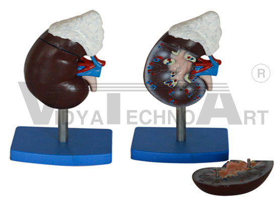 Human Kidney With Adrenal Gland Pharmaceutical and Anatomical Model Gifts